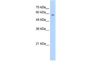 WB Suggested Anti-TPTE Antibody Titration:  2. (TPTE 抗体  (C-Term))