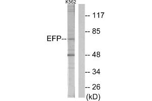 Western blot analysis of extracts from K562 cells, using ZNF147 antibody. (TRIM25 抗体  (Internal Region))