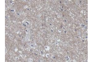 Detection of AMPH in Human Cerebrum Tissue using Polyclonal Antibody to Amphiphysin (AMPH) (Amphiphysin 抗体  (AA 24-241))