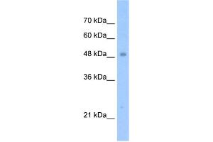WB Suggested Anti-TIGD3 Antibody Titration:  1. (TIGD3 抗体  (N-Term))