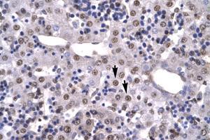 Image no. 3 for anti-High Mobility Group Box 2 (HMGB2) (C-Term) antibody (ABIN6735776) (HMGB2 抗体  (C-Term))