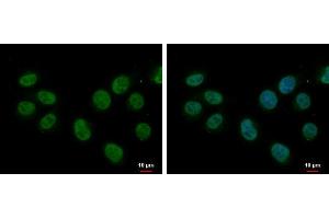 ICC/IF Image splicing factor 1 antibody [N1N3] detects splicing factor 1 protein at nucleus by immunofluorescent analysis. (Splicing Factor 1 抗体)