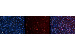 Rabbit Anti-OSBPL8 Antibody   Formalin Fixed Paraffin Embedded Tissue: Human Liver Tissue Observed Staining: Cytoplasm and plasma membrane in Kupffer cells and sinusoids Primary Antibody Concentration: 1:100 Other Working Concentrations: 1:600 Secondary Antibody: Donkey anti-Rabbit-Cy3 Secondary Antibody Concentration: 1:200 Magnification: 20X Exposure Time: 0. (OSBPL8 抗体  (N-Term))