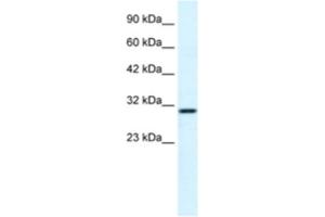 Western Blotting (WB) image for anti-FLJ20729 antibody (ABIN2460993) (FLJ20729 抗体)