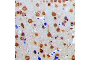 Immunohistochemical analysis of AKAP13 staining in human brain formalin fixed paraffin embedded tissue section. (AKAP13 抗体  (Center))