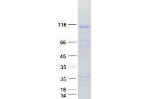 Western Blotting (WB) image for Zinc Finger Protein 606 (ZNF606) protein (Myc-DYKDDDDK Tag) (ABIN2736082)