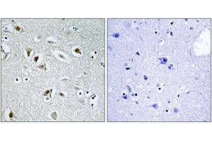 Immunohistochemistry analysis of paraffin-embedded human brain tissue, using CDKA2 Antibody. (CDK2AP2 抗体  (AA 51-100))