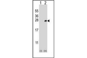 Western blot analysis of Dok5 (arrow) using DOK5 Antibody (PTB domain) Cat. (DOK5 抗体)