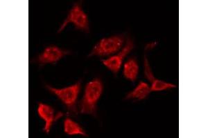 ABIN6266787 staining HeLa by IF/ICC. (NPM1 抗体  (N-Term))