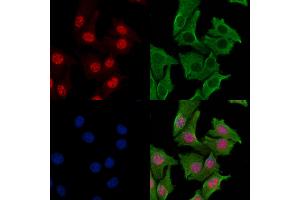 ABIN7093538 and ABIN7097562 staining Hela cells by IF/ICC. (RPA2 抗体)