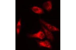 ABIN6275667 staining  COLO205 cells by IF/ICC. (UGDH 抗体  (C-Term))