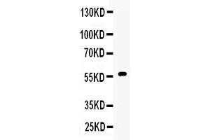 Western Blotting (WB) image for anti-Cytochrome P450, Family 17, Subfamily A, Polypeptide 1 (CYP17A1) (AA 383-419), (C-Term) antibody (ABIN4886555)