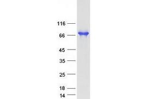 Western Blotting (WB) image for SH3-Domain Binding Protein 5 (SH3BP5) (Transcript Variant 1) protein (Myc-DYKDDDDK Tag) (ABIN2731975)