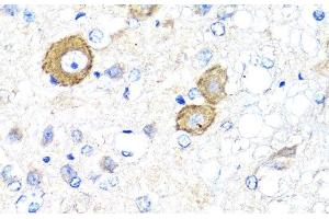 Immunohistochemistry of paraffin-embedded Rat brain using NRG4 Polyclonal Antibody at dilution of 1:100 (40x lens). (Neuregulin 4 抗体)