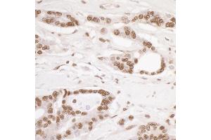 Immunohistochemistry (IHC) image for anti-Damage Specific DNA Binding Protein 1 (DDB1) (C-Term) antibody (ABIN7454634) (DDB1 抗体  (C-Term))