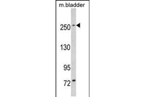 Western blot analysis of LRRK1 in mouse bladder tissue lysates (35ug/lane) (LRRK1 抗体  (C-Term))