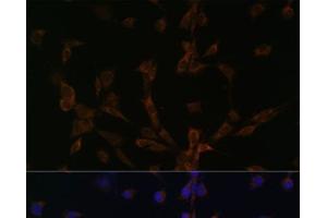 Immunofluorescence (IF) image for anti-Dynein, Light Chain, LC8-Type 2 (DYNLL2) antibody (ABIN7008504)
