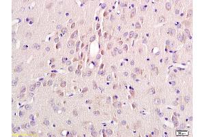 Formalin-fixed and paraffin embedded rat brain labeled with Rabbit Anti Annexin A13 Polyclonal Antibody, Unconjugated (ABIN735323) at 1:200 followed by conjugation to the secondary antibody and DAB staining