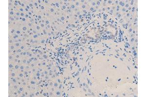 ABIN6267253 at 1/100 staining rat liver tissue sections by IHC-P.
