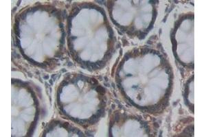 Detection of HJV in Human Rectum Tissue using Polyclonal Antibody to Hemojuvelin (HJV)