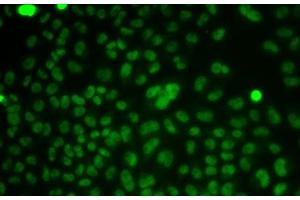 Immunofluorescence analysis of HeLa cells using CSNK2A2 Polyclonal Antibody (CSNK2A2 抗体)