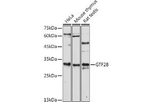 Western blot analysis of extracts of various cell lines, using GTF2B antibody (ABIN7267370) at 1:1000 dilution. (GTF2B 抗体  (AA 50-150))