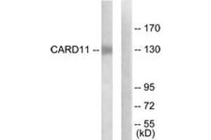 Western blot analysis of extracts from COLO205 cells, using CARD11 Antibody. (CARD11 抗体  (AA 10-59))