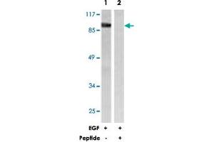 Western blot analysis of extracts from HeLa cells, treated with EGF (200 ng/mL, 30 mins), using CALD1 polyclonal antibody .