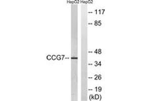Western blot analysis of extracts from HepG2 cells, using CACNG7 Antibody. (CACNG7 抗体  (AA 198-247))