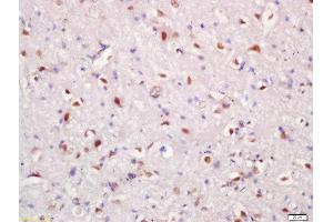 Formalin-fixed and paraffin embedded rat brain tissue labeled with Rabbit Anti-Hrk Polyclonal Antibody, Unconjugated (ABIN2559409) at 1:200 followed by conjugation to the secondary antibody and DAB staining (HRK 抗体  (AA 1-50))