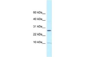 Western Blot showing RPL39 antibody used at a concentration of 1 ug/ml against Fetal Brain Lysate (RPL39 抗体  (N-Term))