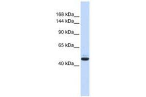 Image no. 1 for anti-Growth Regulation By Estrogen in Breast Cancer 1 (GREB1) (AA 36-85) antibody (ABIN6740577) (GREB1 抗体  (AA 36-85))