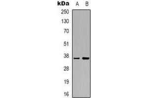 Western blot analysis of AKR1C2 expression in HepG2 (A), Hela (B) whole cell lysates.