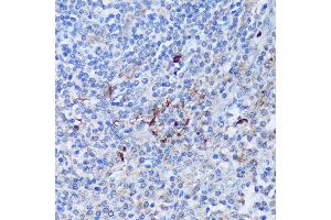 Immunohistochemistry (IHC) image for anti-Peptidyl Arginine Deiminase, Type IV (PADI4) (AA 374-550) antibody (ABIN7269207)