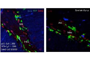 Immunohistochemistry of Mouse anti-p21 antibody. (p21 抗体)