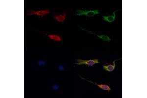 ABIN6259651 and ABIN6268999 staining HepG2 by IF/ICC. (Serotonin Receptor 1A 抗体  (Internal Region))