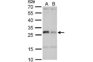 WB Image HLA-DMA antibody detects HLA-DMA protein by Western blot analysis. (HLA-DMA 抗体)