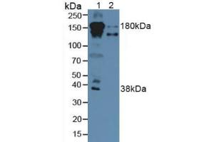 Western blot analysis of (1) Human Serum and (2) Human Liver Tissue. (Complement Factor H 抗体  (AA 860-1231))