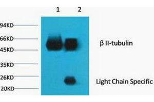 Immunoprecipitation (IP) analysis: 1) Input: Mouse Brain Tissue Lysate. (TUBB2A 抗体)