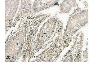 ABIN6257502 and ABIN6274398 at 1/100 staining human normal colon tissue by IHC-P. (STEAP4 抗体  (C-Term))