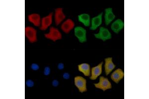 IL12B Mouse Monoclonal Antibody staining HepG2 cells by IF/ICC.