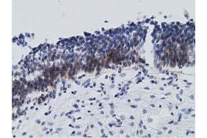 Immunohistochemical staining of paraffin-embedded Human bladder tissue using anti-RBBP9 mouse monoclonal antibody. (RBBP9 抗体)