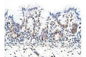 PRKRA antibody was used for immunohistochemistry at a concentration of 4-8 ug/ml to stain Epithelial cells of fundic gland (arrows) in Human Stomach. (PRKRA 抗体  (Middle Region))