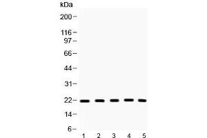 Western blot testing of 1) rat thymus, 2) mouse thymus, 3) mouse Hepa1-6, 3) human HeLa, 4) human MCF7 lysate with Bax antibody at 0.