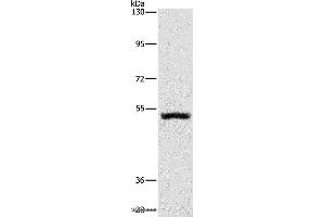Western blot analysis of Mouse kidney tissue, using SYT17 Polyclonal Antibody at dilution of 1:650 (SYT17 抗体)