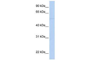 Perforin 1 antibody used at 1 ug/ml to detect target protein. (Perforin 1 抗体)