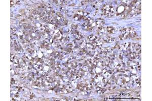 IHC analysis of RFX1 using anti-RFX1 antibody (ABIN7601842).