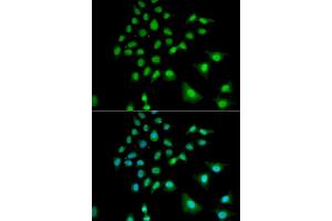 Immunofluorescence analysis of U2OS cells using UBE3C antibody (ABIN5973842). (UBE3C 抗体)