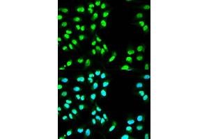 Immunofluorescence analysis of HeLa cell using MCM3 antibody. (MCM3 抗体  (AA 1-295))