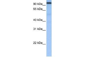 WB Suggested Anti-CPSF2 Antibody Titration:  0. (CPSF2 抗体  (N-Term))